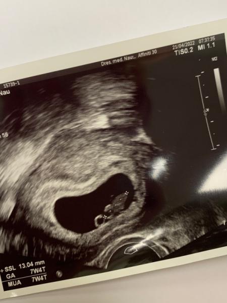 Bild zu Ultraschall 7+4 - Forum für Dezember - Mamis
