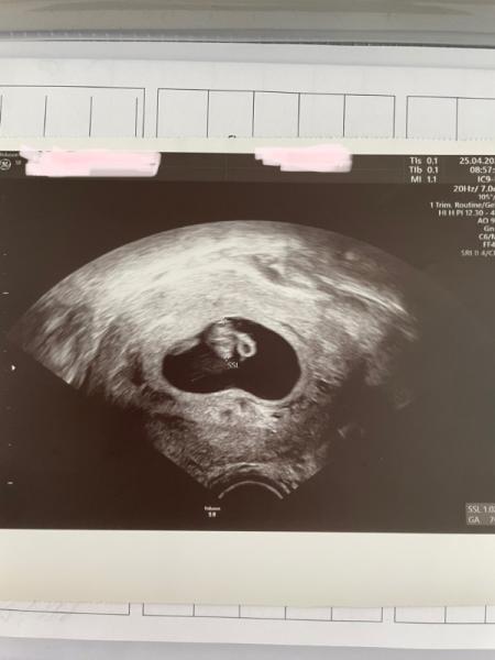 Bild zu Auch wir haben einen ♥️-Schlag - Forum für Dezember - Mamis