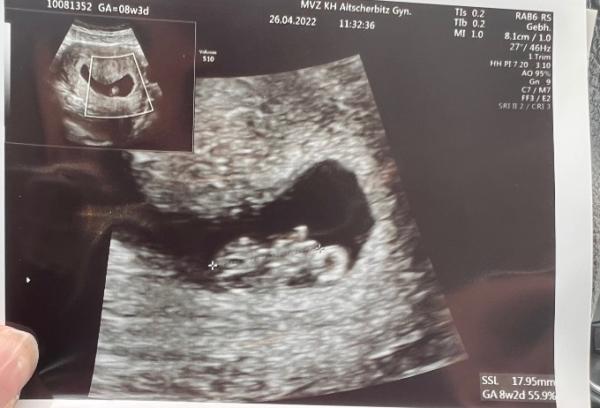 Bild zu Du bist mein wunder Punkt. Du bist mein Wunder, Punkt. - Forum für Dezember - Mamis
