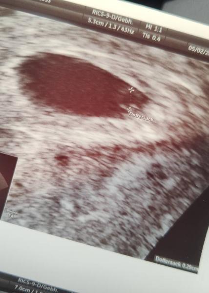 Bild zu Erster US - Forum für Dezember - Mamis