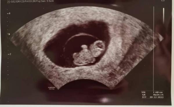 Bild zu Vollbremsung 9.SSW - Forum für Dezember - Mamis