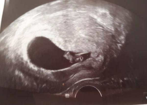 Bild zu Das Herz pocht! Das Herz. Pocht. - Forum für Dezember - Mamis
