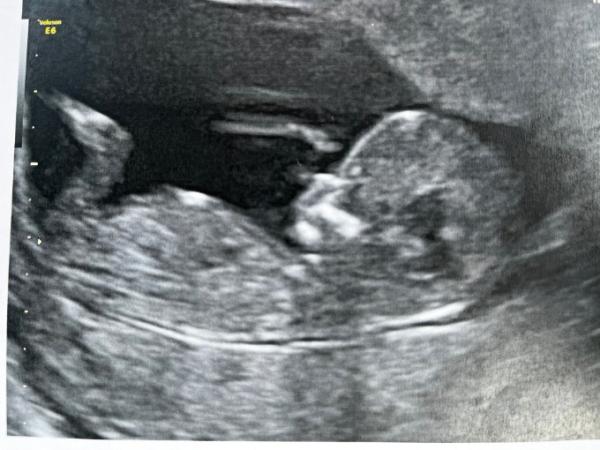 Bild zu Progesteron - Forum für Dezember - Mamis