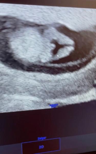 Bild zu Geschlecht 11 SSW - Forum für Dezember - Mamis