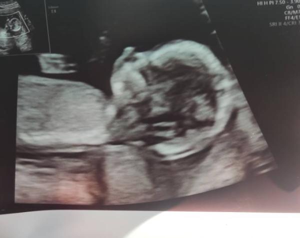 Bild zu Gestriger Termin 😍 - Forum für Dezember - Mamis