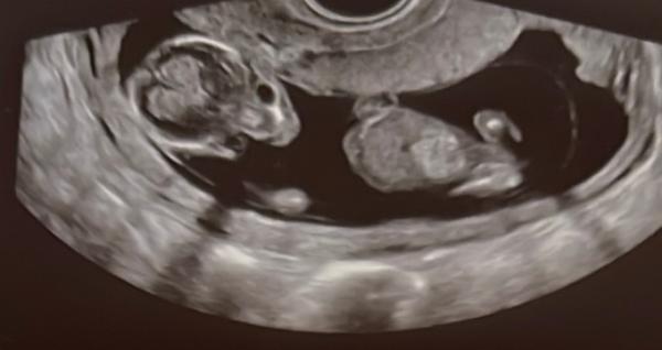 Bild zu NUB Theorie? - Forum für Dezember - Mamis