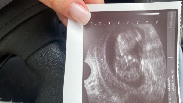 Bild zu Baby ♥️ - Forum für Dezember - Mamis