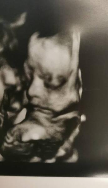 Bild zu Update aus dem Haushalt Motte und Äffchen - Forum für Dezember - Mamis