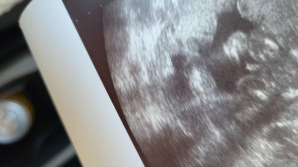 Bild zu Dachte wäre enttäuscht aber dem ist doch nicht so. - Forum für Dezember - Mamis