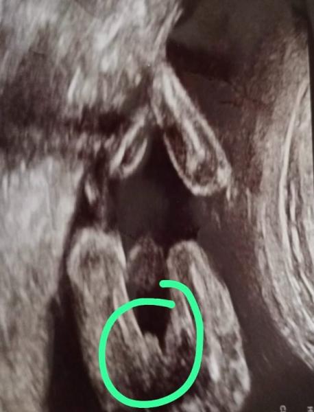 Bild zu Junge oder Mädchen? - Forum für Dezember - Mamis