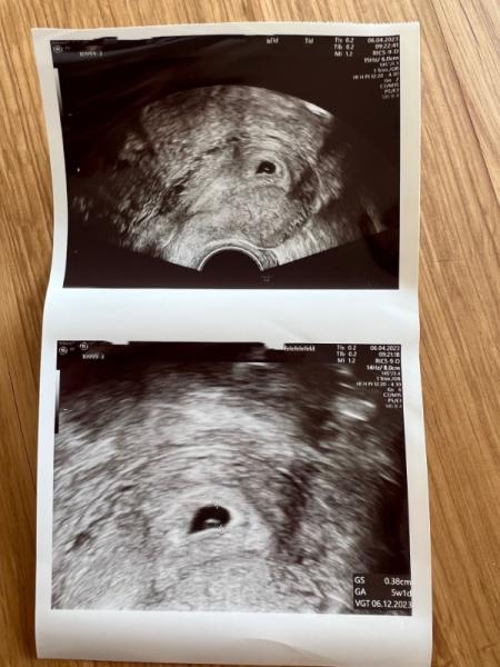 Bild zu Ultraschall 5+1 - Forum für Dezember - Mamis
