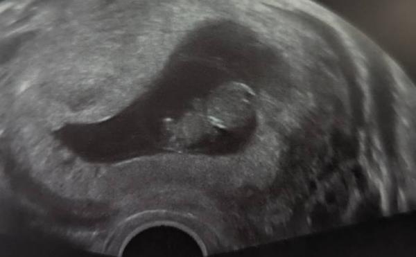 Bild zu 1. Ultraschall:) - Forum für Dezember - Mamis