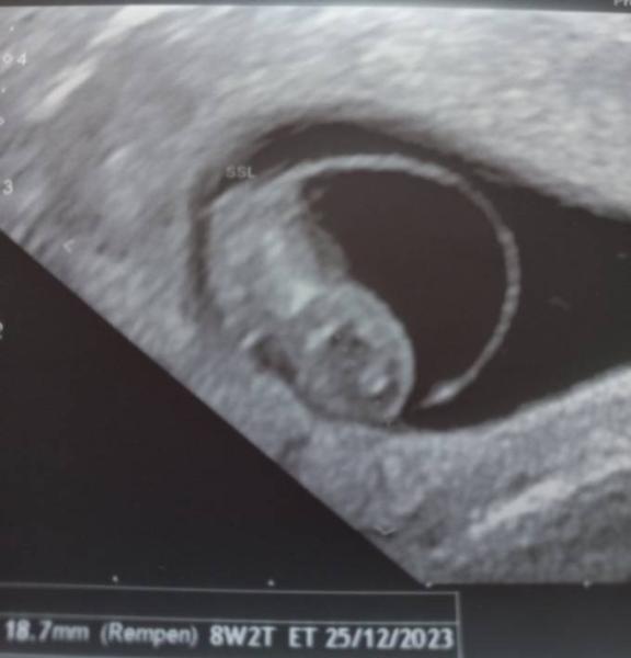 Bild zu Unsere kleine Raupe - Forum für Dezember - Mamis