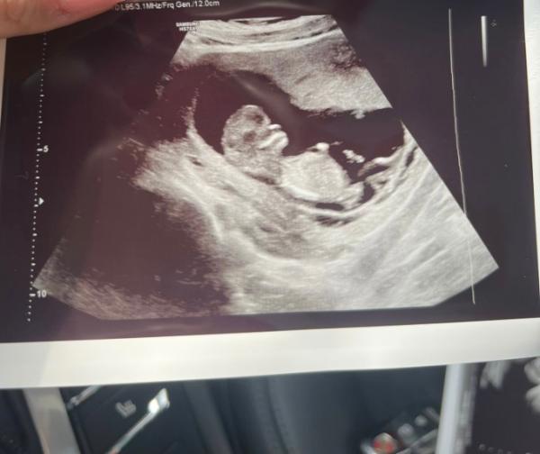 Bild zu Mädels, wie gehts euch? ❤️ - Forum für Dezember - Mamis