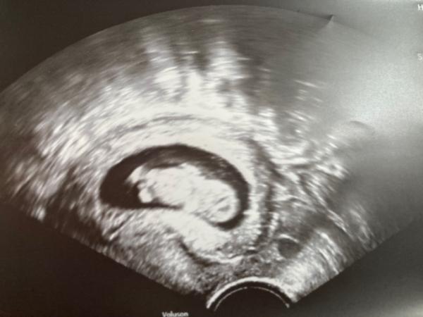 Bild zu 1. großer Ultraschall, ET vorgezogen, alles prima - Forum für Dezember - Mamis
