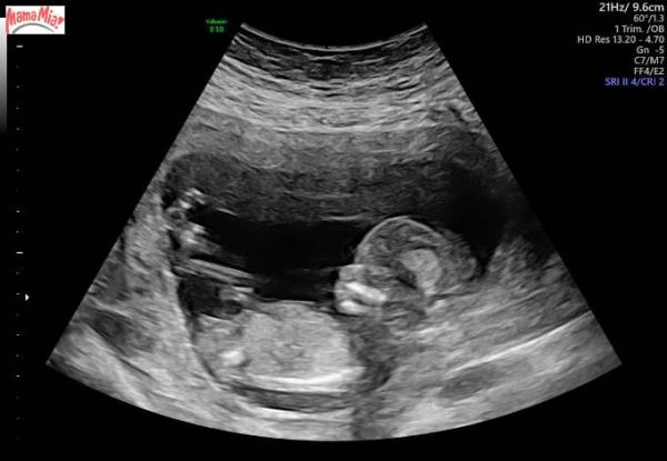 Bild zu geschultes Auge gesucht! - Forum für Dezember - Mamis