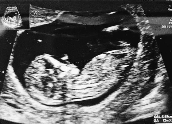 Bild zu Nub/Skull Theorie? - Forum für Dezember - Mamis