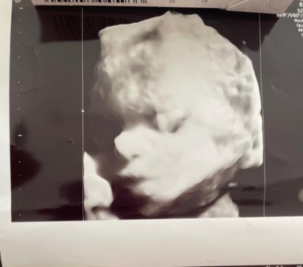 Bild zu Hi, hatte Termin beim Pränataldiag. - Forum für Dezember - Mamis