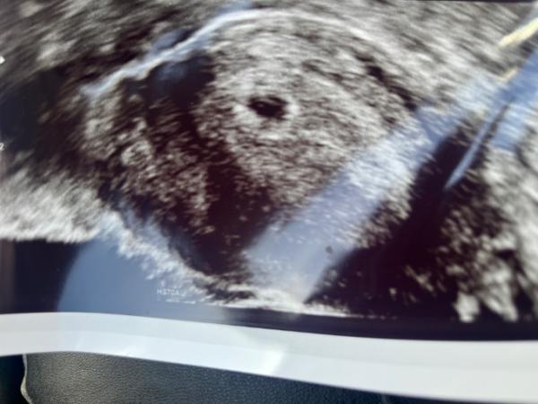 Bild zu 1. ultraschallbild - Forum für Dezember - Mamis