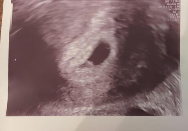 Bild zu Frauenarzttermin 🥹🤰🏽💗 - Forum für Dezember - Mamis