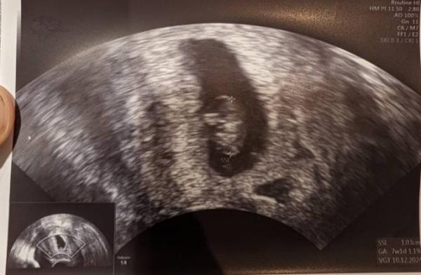 Bild zu 🤰🏽🐢 - Forum für Dezember - Mamis