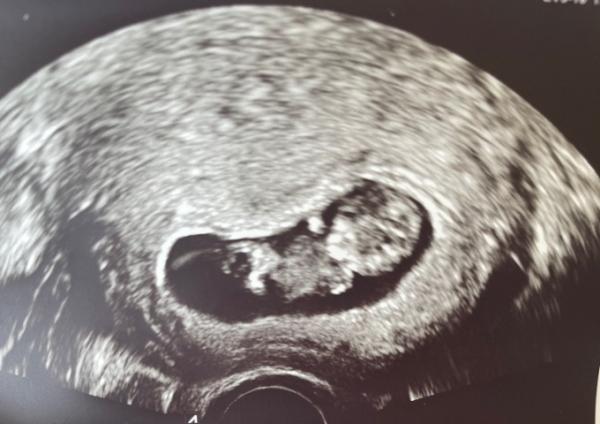 Bild zu Hallo mini mensch! - Forum für Dezember - Mamis