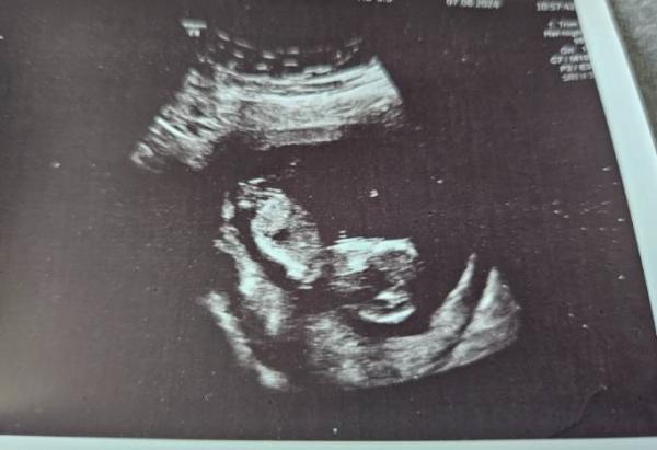 Bild zu Nächster US und NIPT bei 12+4🥰 - Forum für Dezember - Mamis