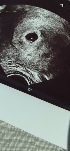 Bild zu FA Termin - Forum für Dezember - Mamis