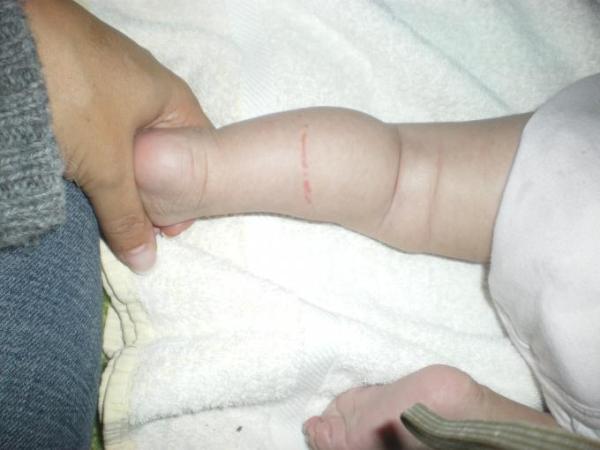 Bild zu ....was um himmels willen ist das ??? - Baby Forum - Allgemeine Themen