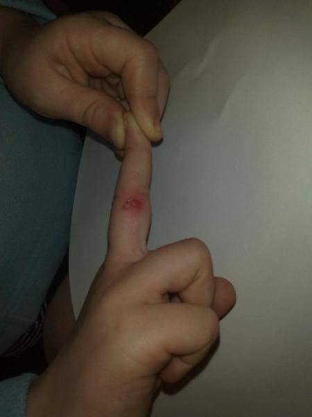 Bild zu hier einmal der finger - Baby Forum - Allgemeine Themen