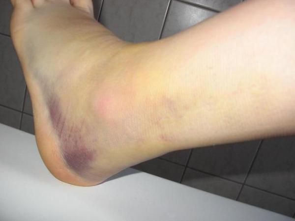 Bild zu 