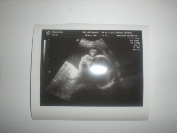 Bild zu skr - Baby Forum - Allgemeine Themen