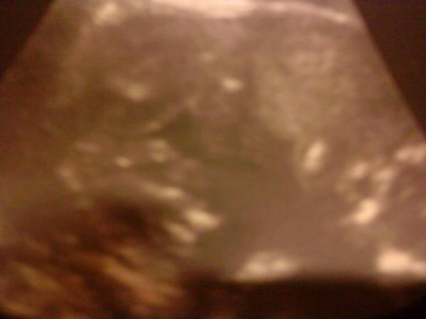 Bild zu schaut ma - Baby Forum - Allgemeine Themen