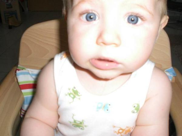 Bild zu Schaut mal, wer mich heute gebissen hat - Baby Forum - Allgemeine Themen