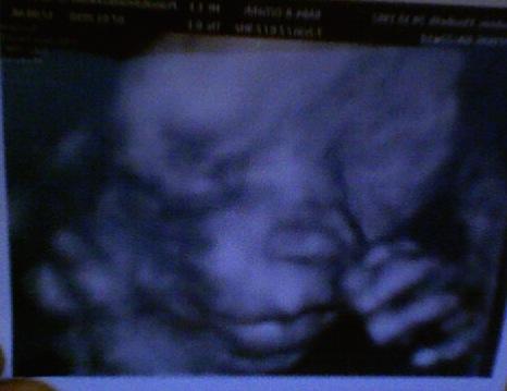 Bild zu skr,schau mal! - Baby Forum - Allgemeine Themen