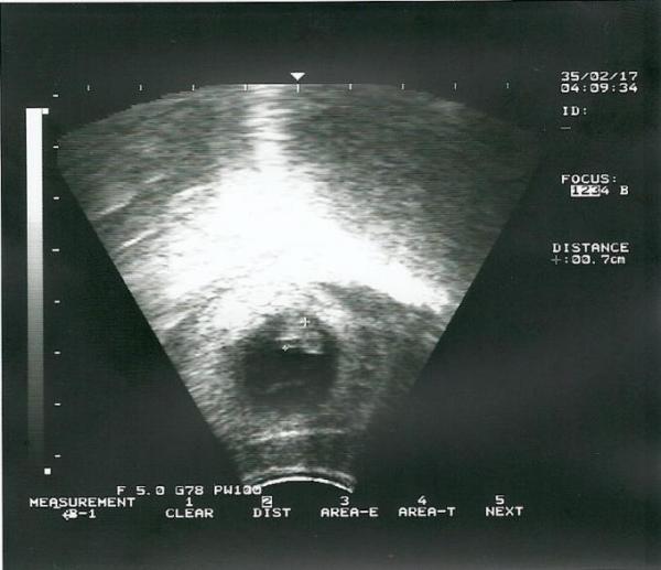 Bild zu Erstes US-Bild! - Baby Forum - Allgemeine Themen