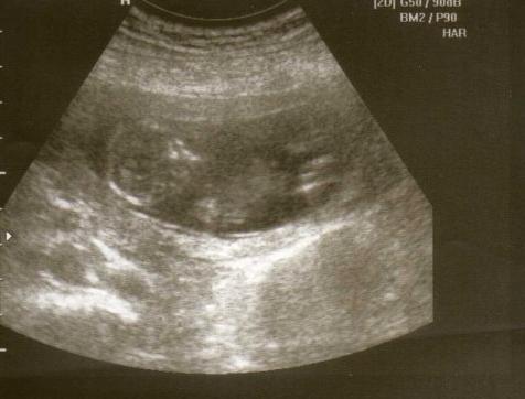 Bild zu @jeromes - Baby Forum - Allgemeine Themen
