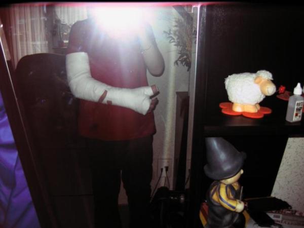 Bild zu vor 3  wochen nen unfall hatte , heute arm in gips *heuullll* - Baby Forum - Allgemeine Themen