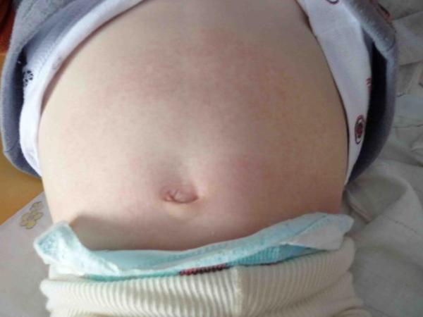 Bild zu Hilfe, was ist?! Was kann das sein?! - Baby Forum - Allgemeine Themen