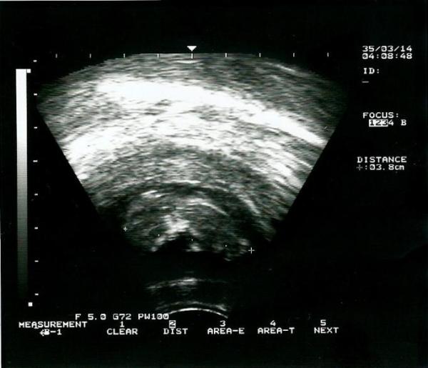 Bild zu Bilder - Baby Forum - Allgemeine Themen