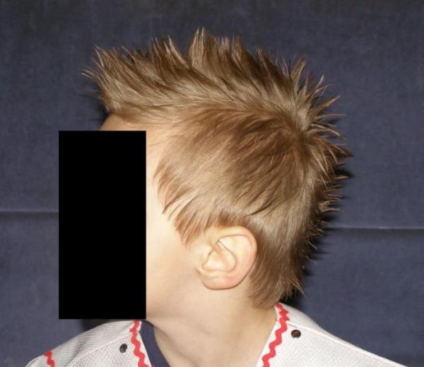 Bild zu