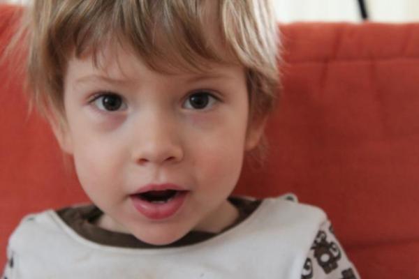 Bild zu