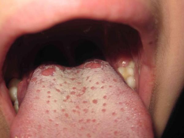 Bild zu Was ist das? - Baby Forum - Allgemeine Themen