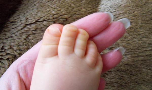 Bild zu Sind die Füße vom Kind gelblich? - Baby Forum - Allgemeine Themen