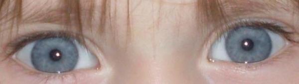 Bild zu DAS sind schöne augen - Baby Forum - Allgemeine Themen