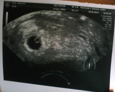 Bild zu Tigelein! - Baby Forum - Allgemeine Themen
