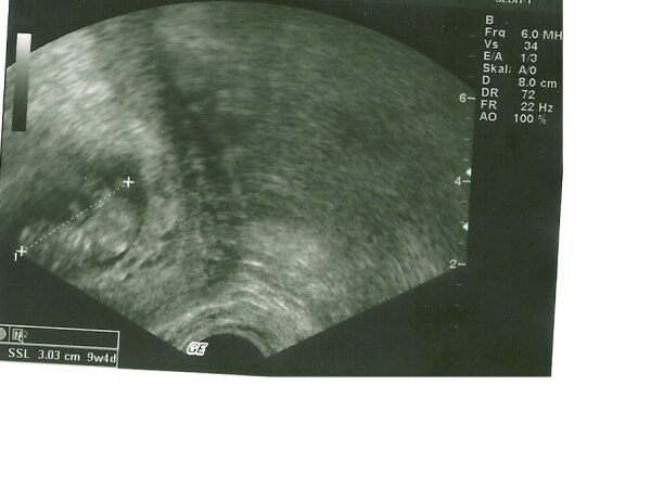 Bild zu Mein Baby - Baby Forum - Allgemeine Themen