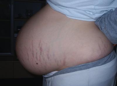 Bild zu Mein SS Bauch in der 30. SSW als ich mit meiner Lotte schwanger war. - Baby Forum - Allgemeine Themen