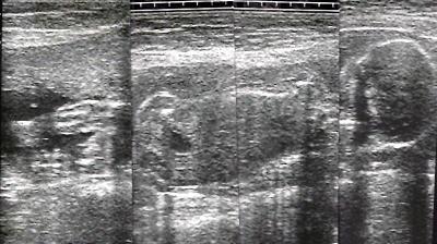 Bild zu FA-Bericht + US-Bild - Baby Forum - Allgemeine Themen