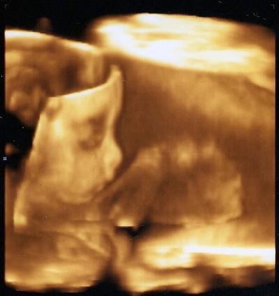 Bild zu 3D-US-Bild + Outing!! - Baby Forum - Allgemeine Themen